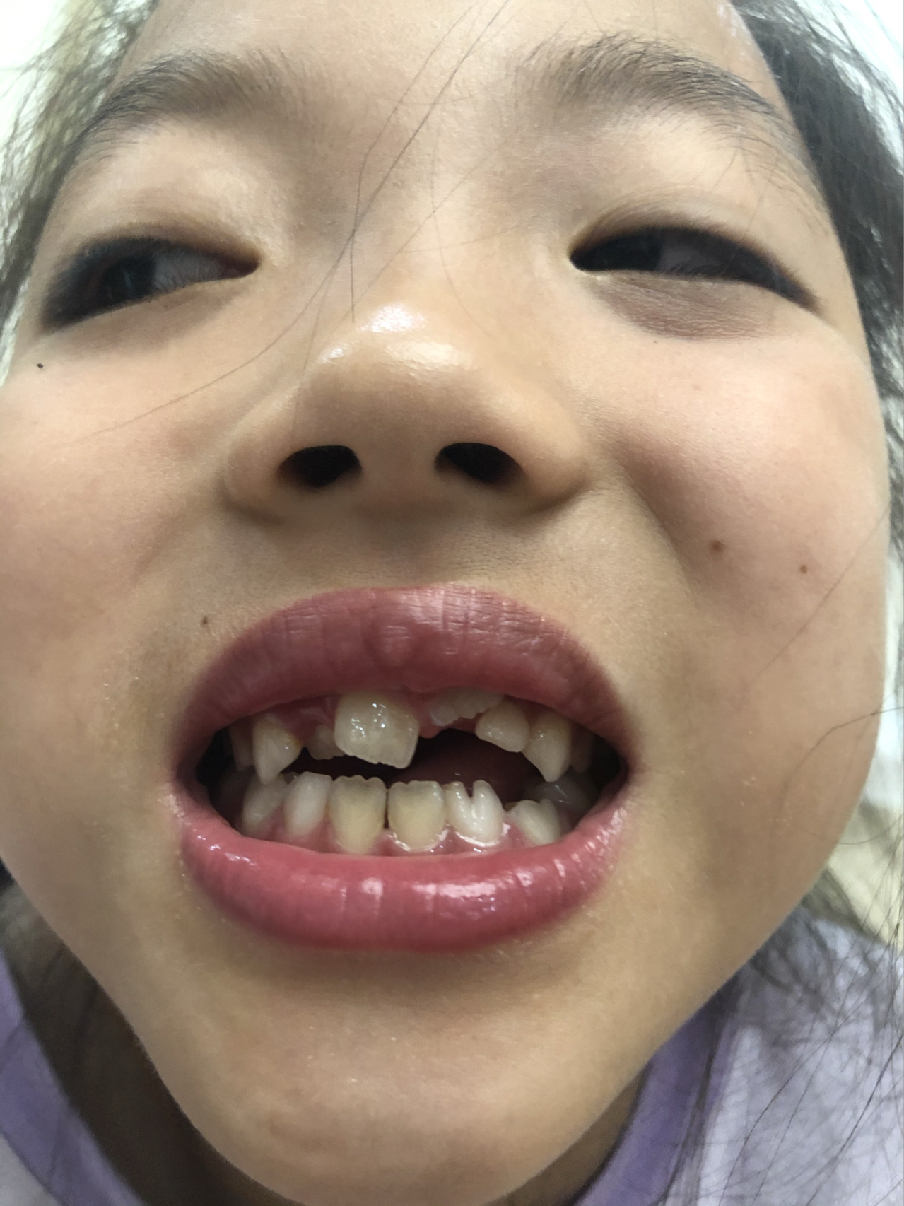 莊最新牙齒技術(shù)揭秘，牙齒美容新選擇